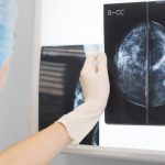 Dia Nacional da Mamografia | Diretor da MedPlus, Tiago Simões Leite chama atenção para necessidade de radiologistas.