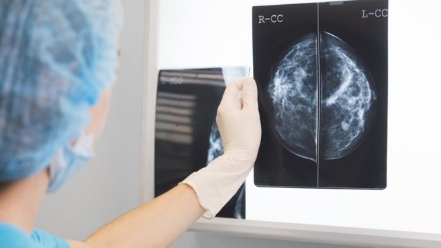 Dia Nacional da Mamografia | Diretor da MedPlus, Tiago Simões Leite chama atenção para necessidade de radiologistas.